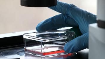 Investigadores españoles descubren cómo diagnosticar una miocarditis con una gota de sangre