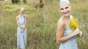 Una joven con alopecia celebra su calvicie con una sesión de fotos