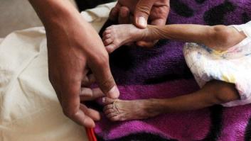 El hambre, una lacra que tú puedes convertir en historia