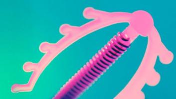 El DIU puede proteger contra el cáncer de cuello uterino