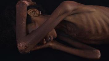 La sangre derramada en Yemen