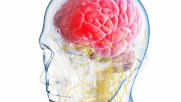 Cirugía contra la migraña: en qué consiste y qué efectividad tiene