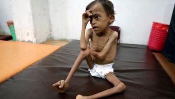 815 millones de personas pasan hambre en el mundo