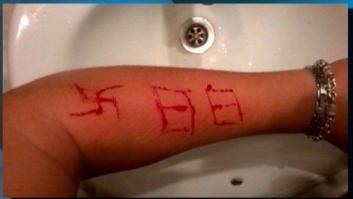 Unos neonazis graban a cuchillo una esvástica a un menor en Bilbao
