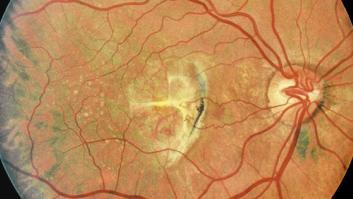 Avance contra la ceguera: ratas recuperan la visión gracias a un transplante celular