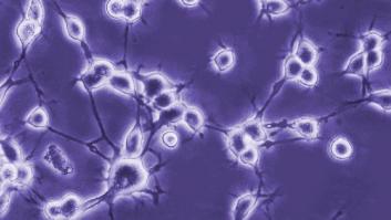 Consiguen restaurar funciones nerviosas dañadas por el párkinson con células madre