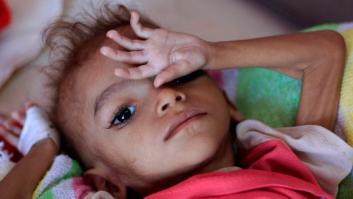 821 millones de personas en el mundo no comen lo suficiente; 672 millones son obesas