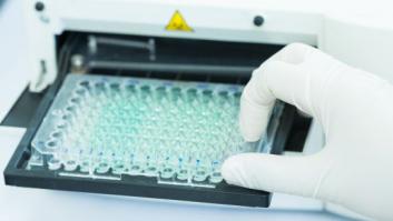 Investigadores españoles detectan que el transplante de células madre podría erradicar el VIH en el organismo