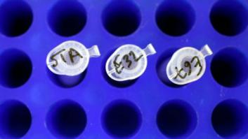 Completar el tratamiento de antibióticos puede poner en riesgo la salud