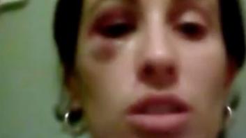 Una educadora social, tras ser agredida por una menor: "Los niños se creen intocables"