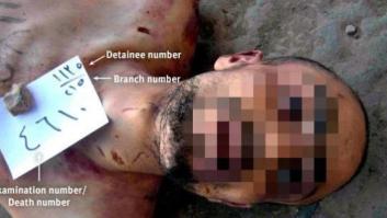 Así se muere en las cárceles de Siria