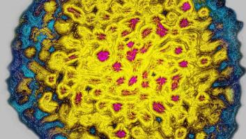 La hepatitis C podría quedar erradicada en España en 2021