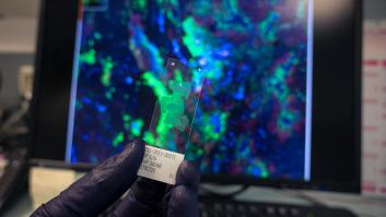 Un tratamiento experimental del Clinic de Barcelona logra la remisión completa de un cáncer en pacientes sin alternativa