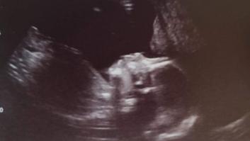 Mi hija me está haciendo mejor hombre, y eso que aún no ha nacido