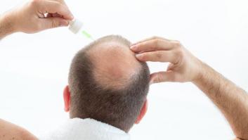 Los tratamientos para no quedarse calvo defraudan a 7 de cada 10 consumidores