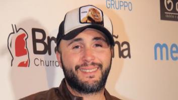 Kiko Rivera presume en la playa de los resultados de su reducción de estómago