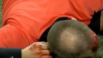 Vergonzoso: abren la cabeza a un juez de línea en un partido de Europa League