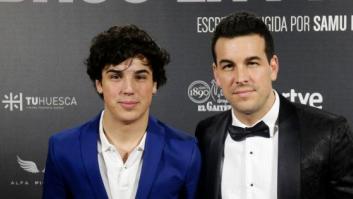 El hermano de Mario Casas comparte una foto de su cara tras sufrir un accidente