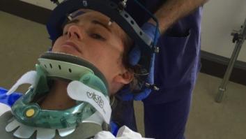 Una mujer se rompe el cuello estornudando... dos veces