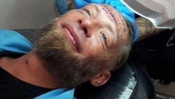 Unos británicos de despedida de soltero en Benidorm pagan a un indigente por tatuarse en la frente el nombre del novio