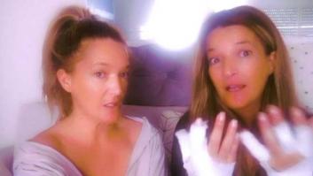 Una de 'Las Mellis' sufre quemaduras de segundo grado por tratarlas con un remedio casero