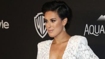 Rumer Willis acusa a unos fotógrafos de haberse pasado con el Photoshop en su barbilla