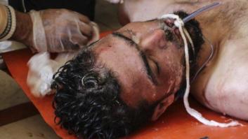 MSF confirma que las víctimas de Jan Sheijun presentan síntomas compatibles con un ataque químico