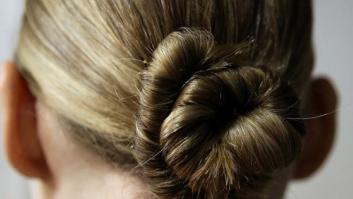 ¿Qué es lo que pasa cuando 'nos duele el pelo'?