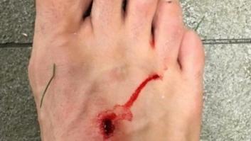 La respuesta de Suárez a la foto del pie de Filipe: "El fútbol es cosa de hombres"