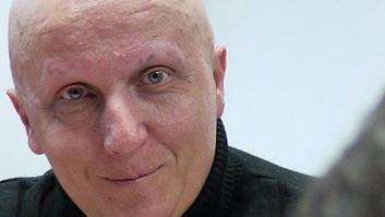 Detenido por estafa un hombre que pedía dinero para tratarse 2.000 tumores