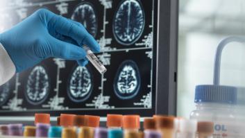 Investigan una segunda muerte relacionada con un fármaco experimental contra el alzhéimer