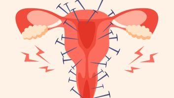 Dolor, vómitos o desmayos: cómo es vivir con reglas dolorosas