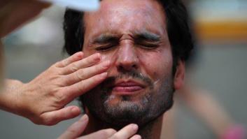 Indignación general por la respuesta de un farmacéutico a un cliente que quería crema solar