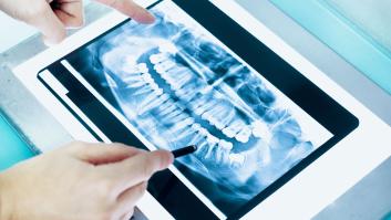 Boca sana para la salud cerebral