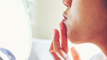 Esto es lo que provoca una ola de calor en tu piel