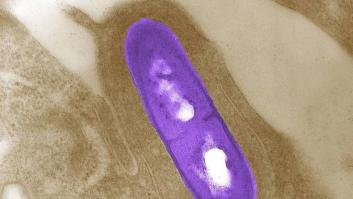 Listeriosis: ¿dónde ha estado el fallo?