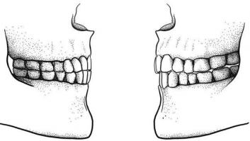 Los alimentos blandos y procesados cambiaron la forma de hablar del ser humano
