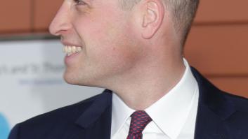 Cómo quedarte calvo con estilo