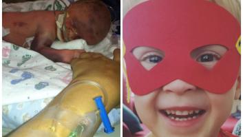 El antes y el después de estos bebés prematuros es la viva imagen de la fortaleza