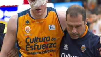 El tremendo codazo de Pablo Aguilar a su compañero Luke Harangody