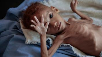 La generación que iba a acabar con el hambre está aumentando el número de hambrientos