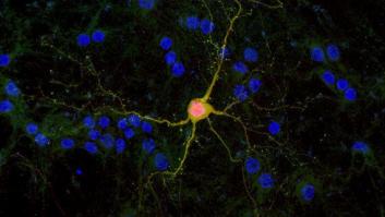 Siete grandes descubrimientos científicos posibles gracias a los microscopios