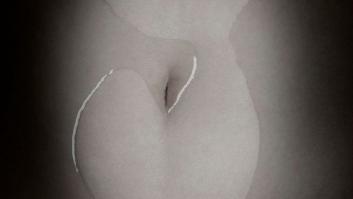 La cacerola gástrica