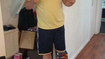 Matt Cronin, el hombre que construyó su prótesis... con piezas de LEGO