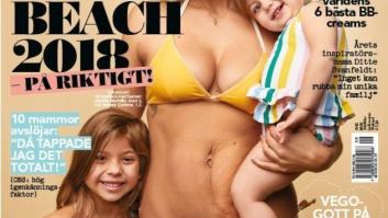 Esta modelo presume de estrías postparto para luchar contra las imposiciones estéticas