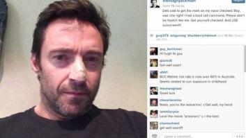 Hugh Jackman tiene cáncer de piel (FOTOS)