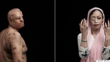 Todas las imágenes ganadoras de los Sony World Photography Awards 2016