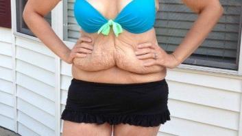 Por qué me negué a posar con camiseta después de perder 78 kilos