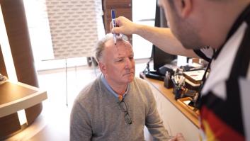 Los avances de la microcirugía capilar en el tratamiento de la alopecia