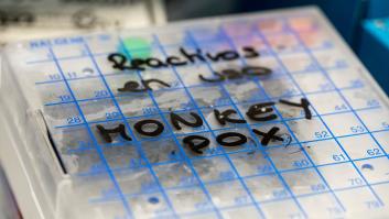 Los casos de viruela del mono aumentan más de un 20% en Europa en los tres últimos días